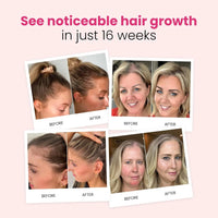 tryphora Hair Growth Shampoo